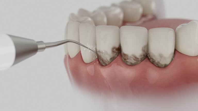 Trusted Emergency Dentist service in Twinsburg, OH - Dentist Open Now